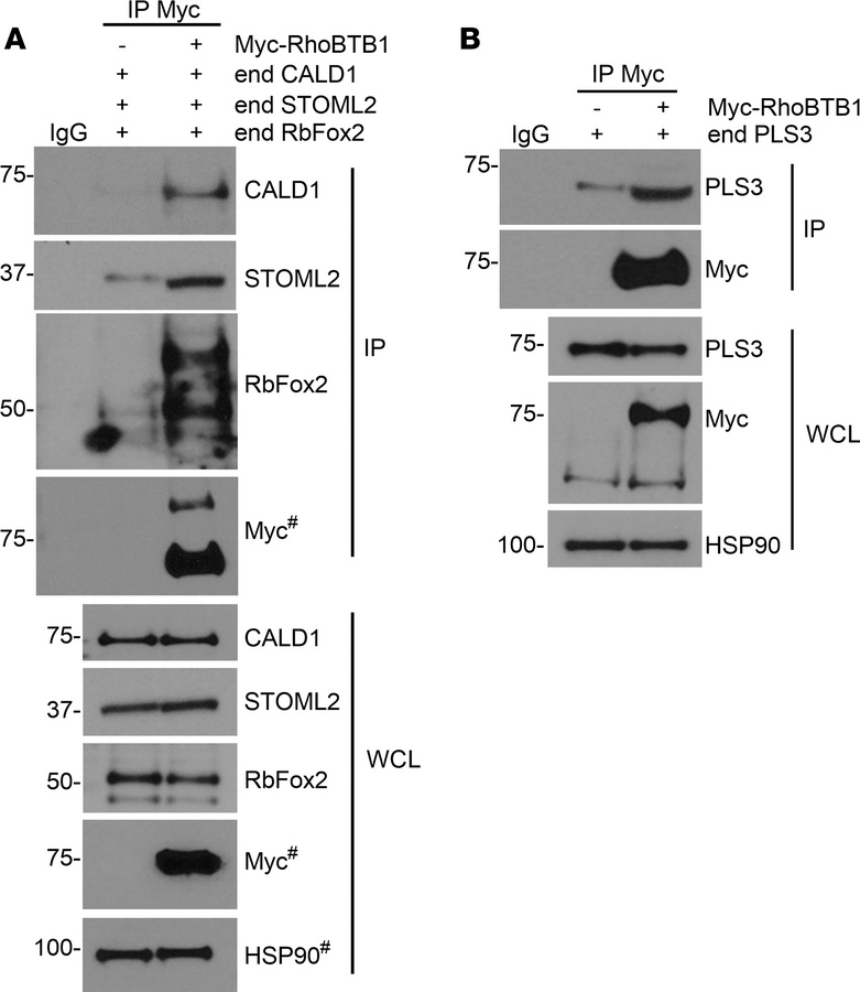 Differential interaction of RhoBTB1 target proteins with full-length Rho...
