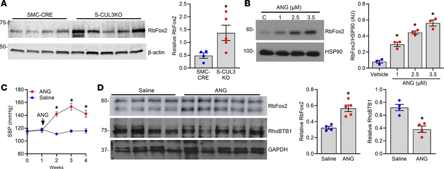 Expression of RbFox2 in various models of hypertension.
(A) Representati...
