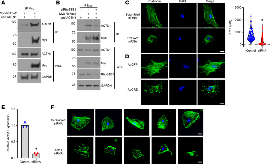 Interaction of RbFox2 with Actn1 and its role in cytoskeletal modulation...
