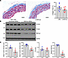 Role of RbFox2 in cytoskeletal modulation.