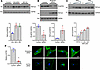 Role of RbFox2 and Actn1 in primary human aortic SMCs.