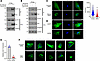 Interaction of RbFox2 with Actn1 and its role in cytoskeletal modulation.