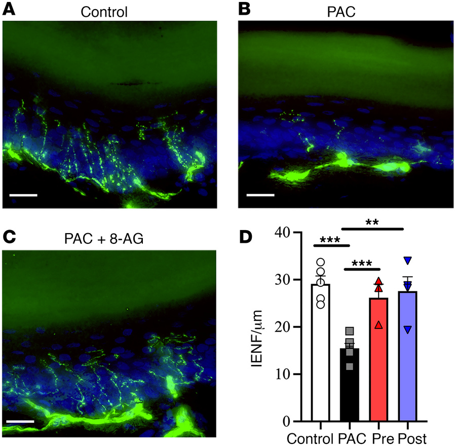 8-Aminoguanine attenuates PAC-related changes in intraepidermal nerve fi...