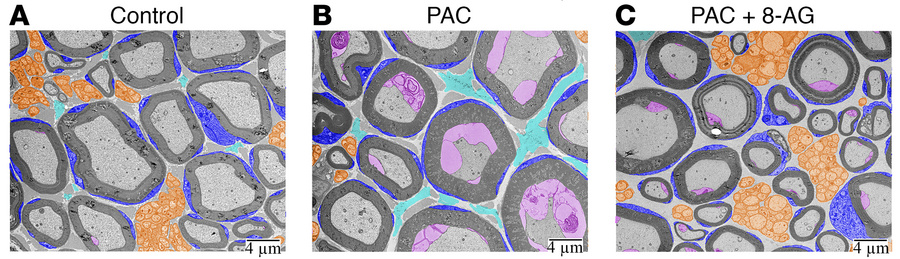 8-Aminoguanine attenuates PAC-related changes in small-diameter fibers i...