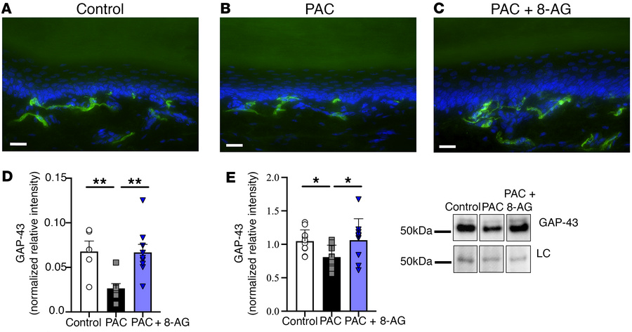 8-Aminoguanine facilitates nerve regeneration following PAC treatment.
R...