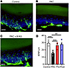 8-Aminoguanine attenuates PAC-related changes in intraepidermal nerve fiber