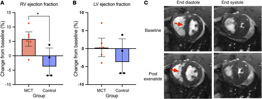 Effects of exenatide in the monocrotaline PAH model.
(A and B) The chang...