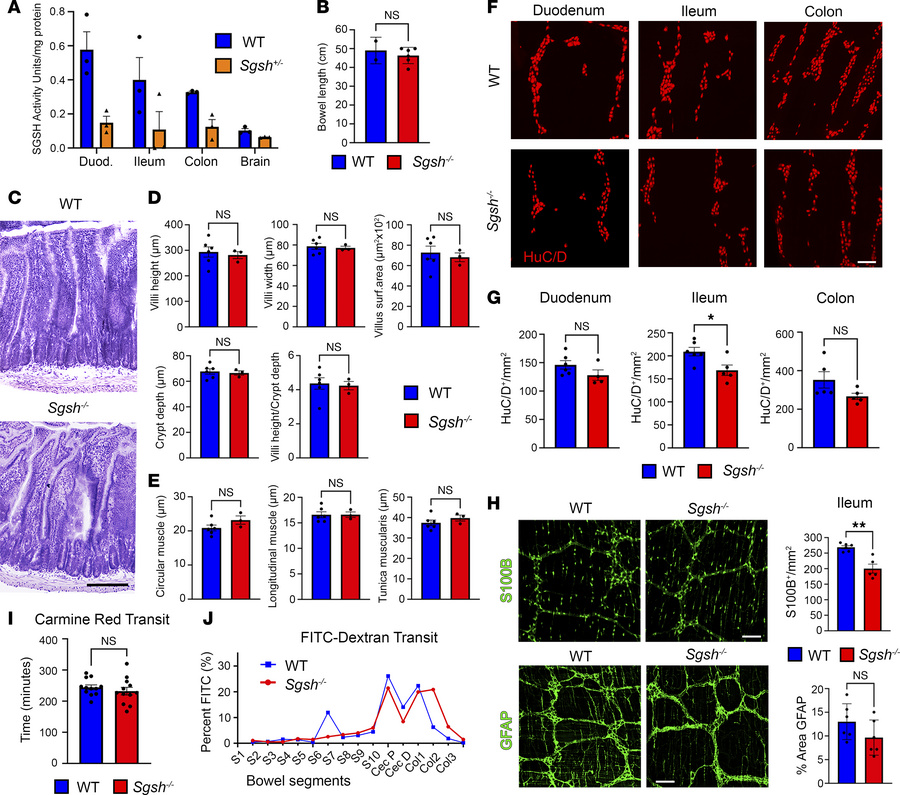 Lack of severe enteric phenotypes in disease endstage MPS IIIA mice.
(A)...