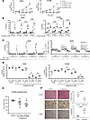 β-Lapachone reduces lung cancer cell proliferation and increases apoptosis.