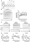 β-Lapachone antagonizes USP18-dependent activity.