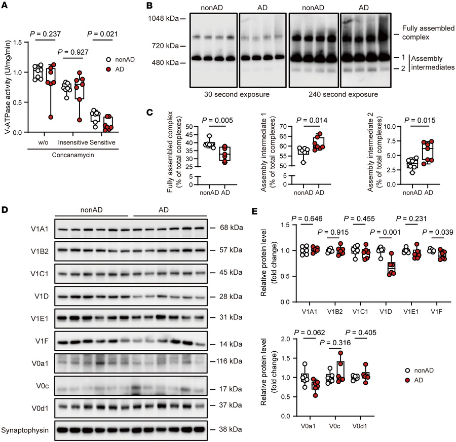 V-ATPase dysfunction in SV-rich fractions from patients with AD.
(A) Mea...
