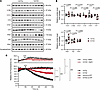 Reduced V1D expression and impaired acidification in SV-rich fractions from