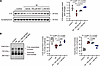 Aβ-induced oxidative stress promotes V-ATPase disassembly in SVs via V1D lo