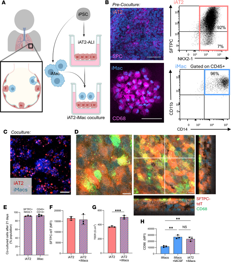Establishment of iPSC-derived AT2 and macrophage air liquid interface co...