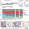 Spatial enrichment of T cell subsets in regions of epithelial abnormality a