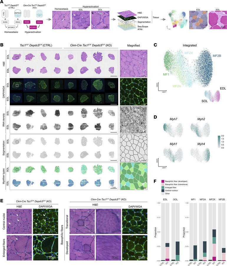 Seq-Scope enables histopathology-guided single-myofiber transcriptome an...
