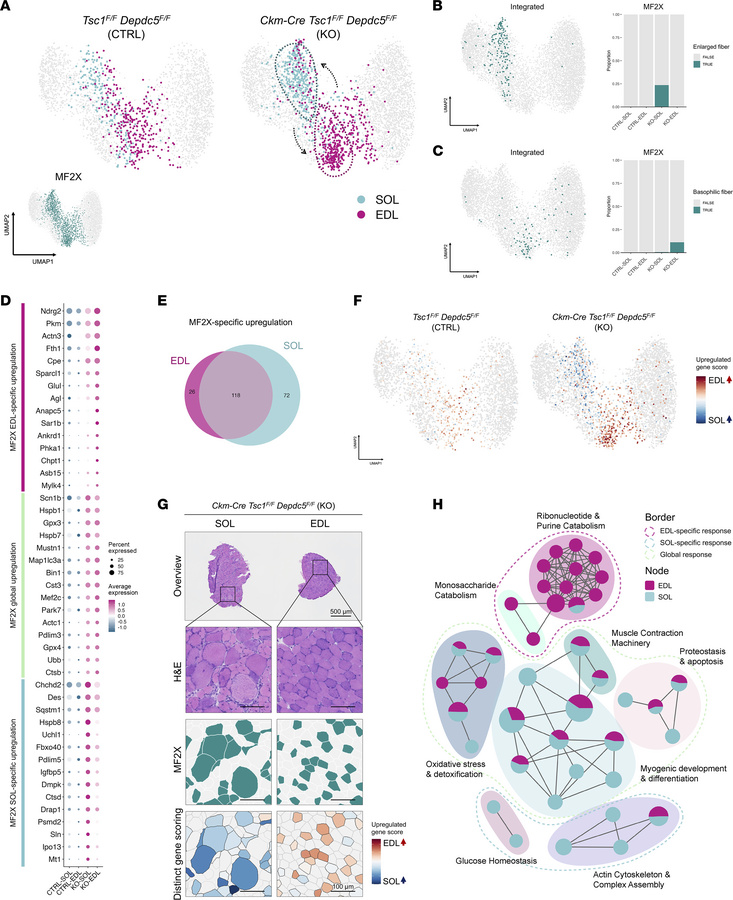 Distinct hyperactive mTORC1 responses of type IIx myofibers in different...