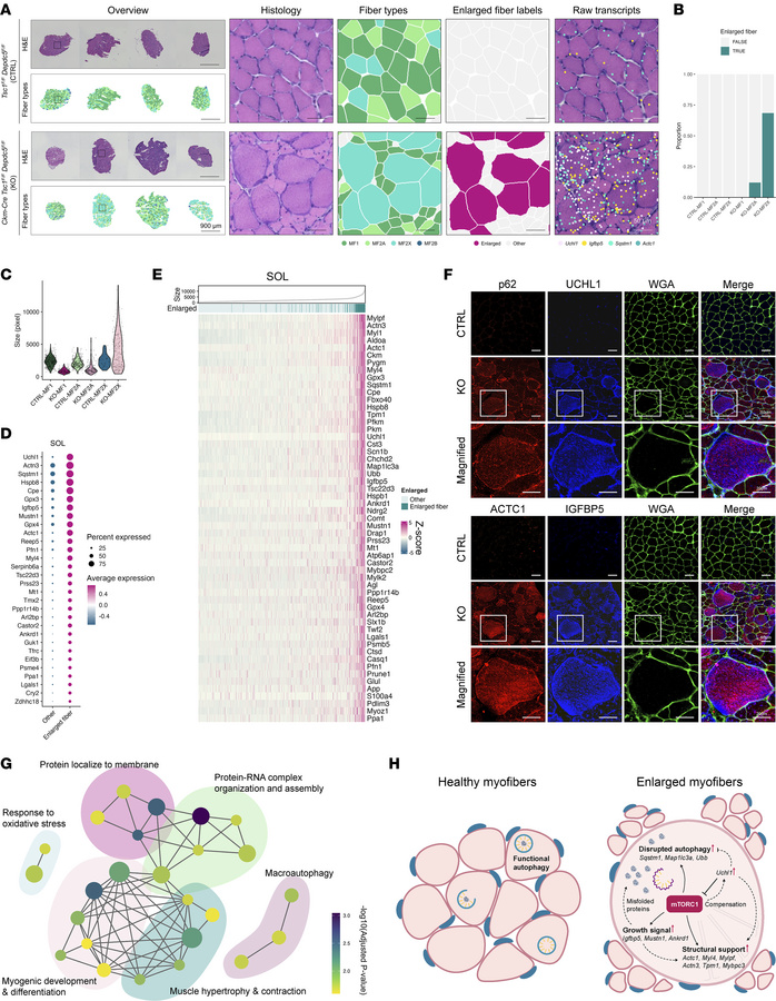Type IIx myofibers in SOL undergo hypertrophy with structural remodeling...