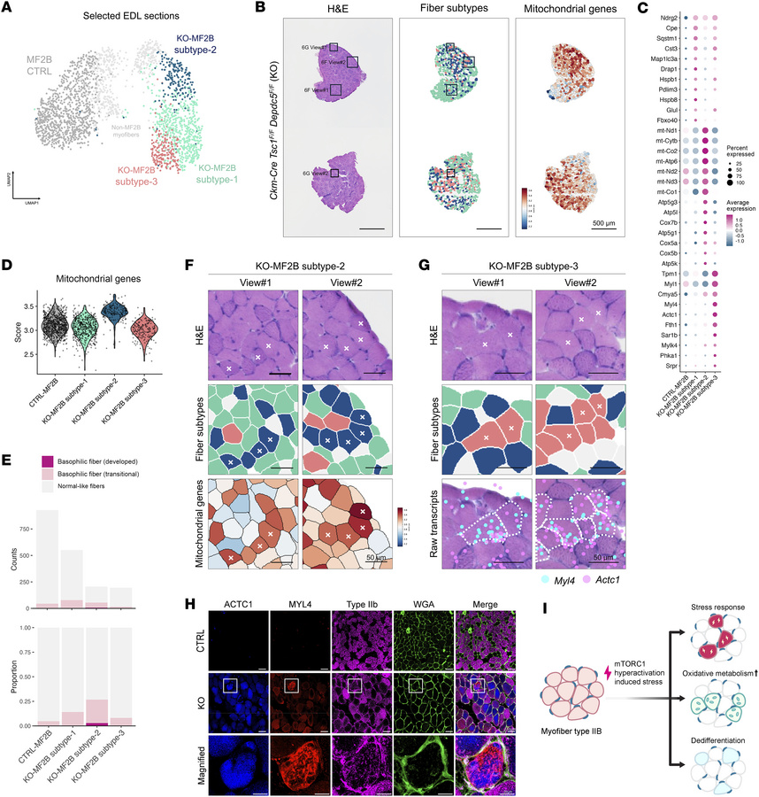 Type IIb fibers in EDL exhibit 3 distinct transcriptional states without...