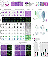 Seq-Scope enables histopathology-guided single-myofiber transcriptome analy