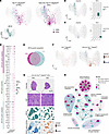 Distinct hyperactive mTORC1 responses of type IIx myofibers in different mu