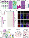 Type IIx myofibers in SOL undergo hypertrophy with structural remodeling.