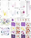 Basophilic fibers are associated with increased RNA and metabolism-related