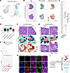 Type IIb fibers in EDL exhibit 3 distinct transcriptional states without gr