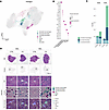 mTORC1 hyperactivation drives macrophage-fibroblast accumulation in SOL mus