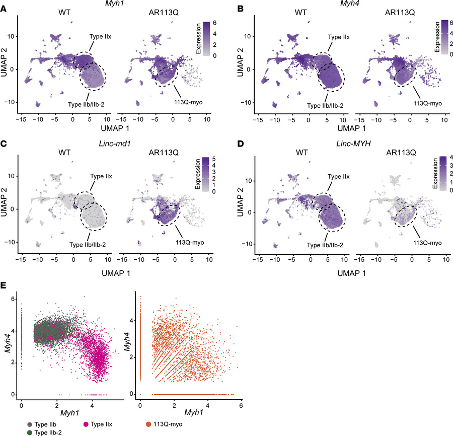 Altered expression of Myh1 and Myh4 in AR113Q muscle.
(A–D) Expression o...