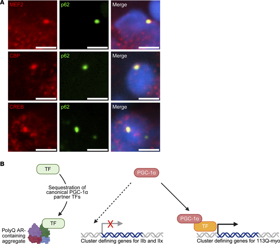 Model of polyQ-mediated transcriptional dysregulation in skeletal muscle...