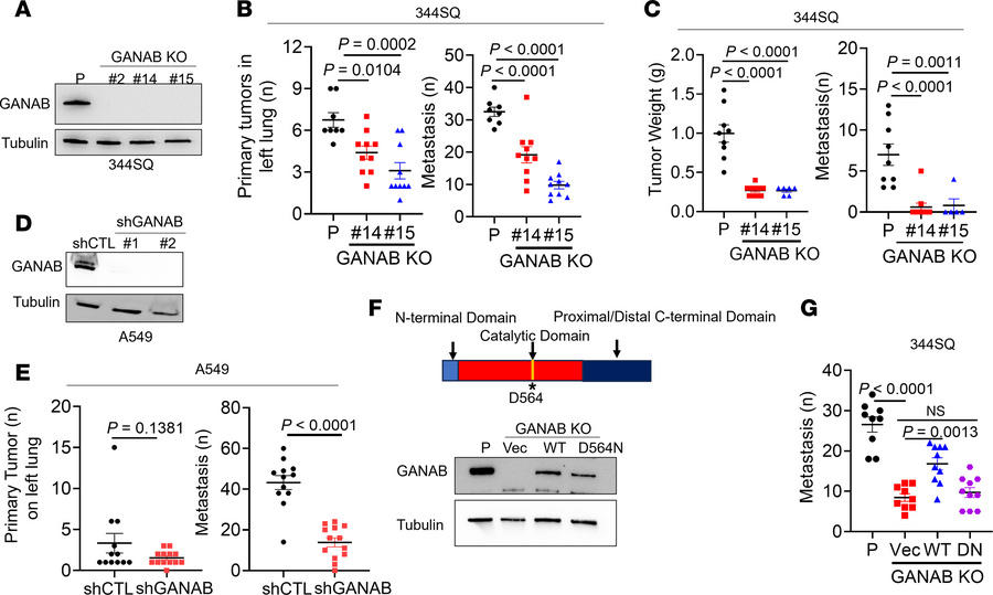 GANAB promotes tumor growth and metastasis in a enzymatic activity-depen...
