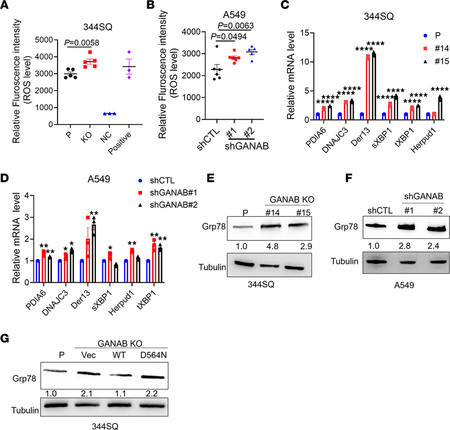 GANAB deficiency induces ER-stress.
(A) ROS level analysis in P- and GAN...