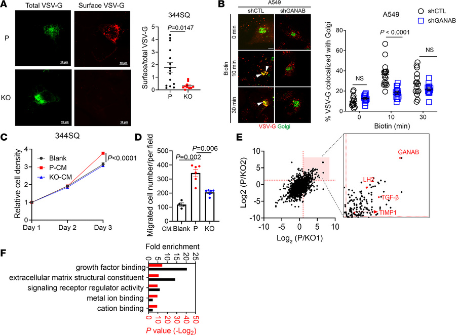 GANAB regulates secretion.
(A) Representative images (left panel) and qu...