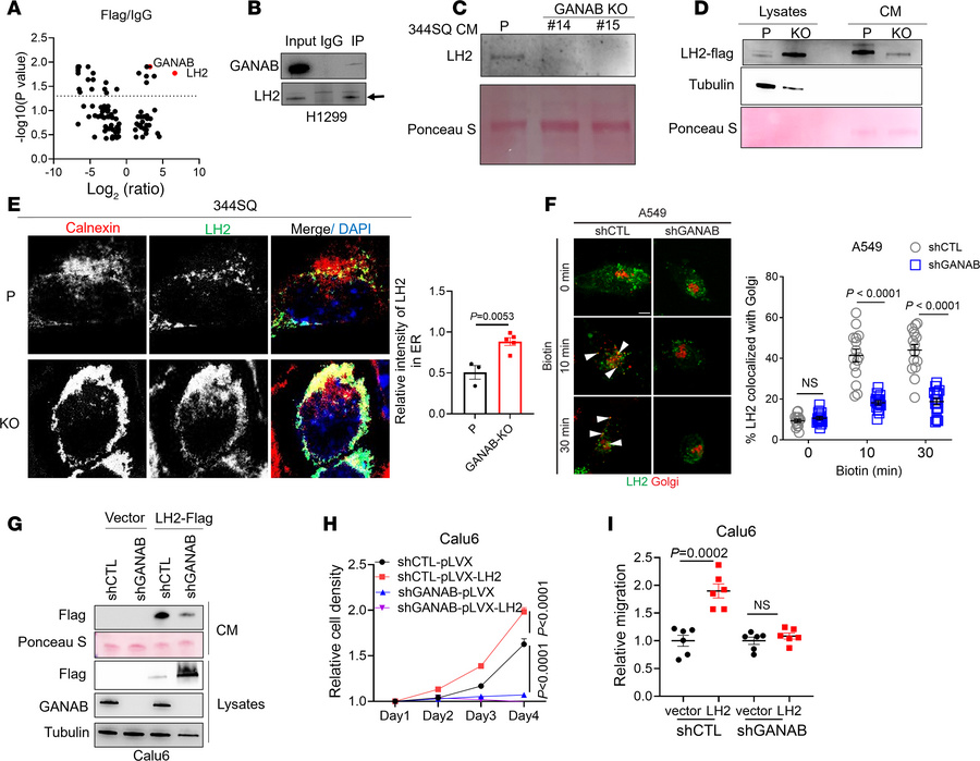 GANAB regulates the secretion and function of LH2.
(A) Volcano plot of p...
