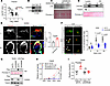 GANAB regulates the secretion and function of LH2.