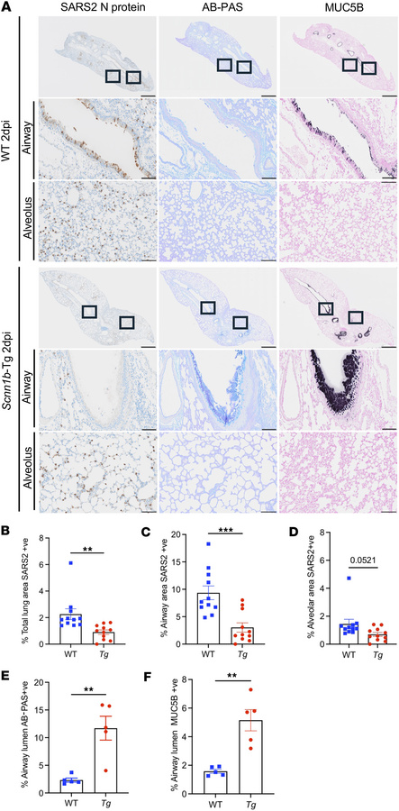 Airway epithelium of Scnn1b-Tg mice is resistant to infection with SARS-...