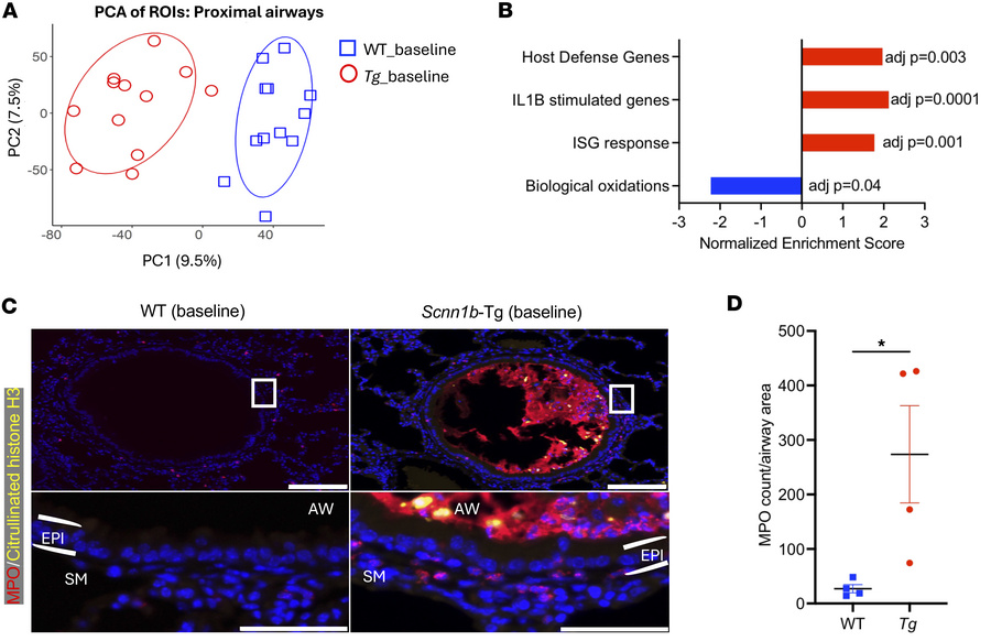 Airway epithelium of Scnn1b-Tg mice shows epithelial and immune priming ...