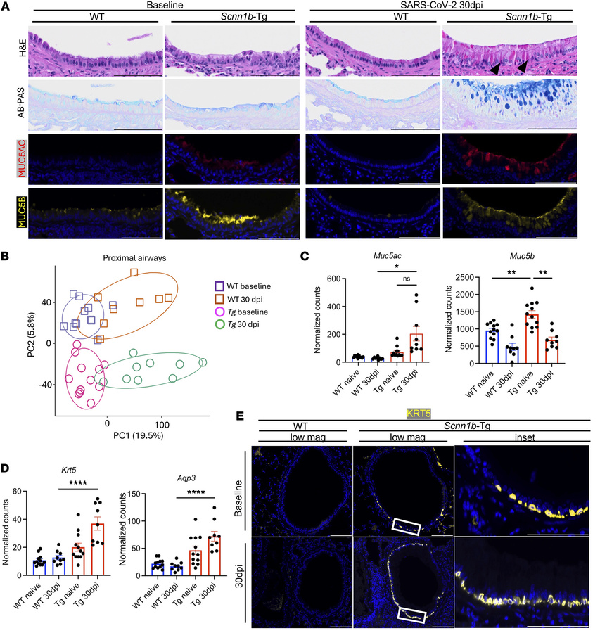 SARS-CoV-2 MA10 infection induces MUC5AC-rich goblet cell metaplasia in ...