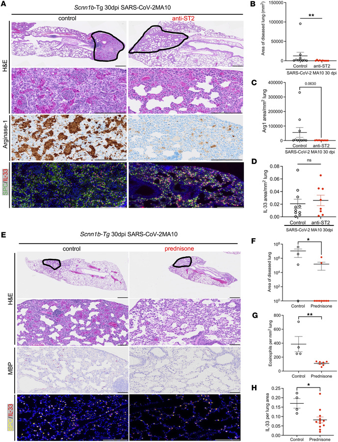Therapeutic benefit of IL-33 pathway inhibition and prednisone treatment...