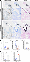 Airway epithelium of Scnn1b-Tg mice is resistant to infection with SARS-CoV