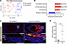 Airway epithelium of Scnn1b-Tg mice shows epithelial and immune priming tha