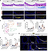 SARS-CoV-2 MA10 infection induces MUC5AC-rich goblet cell metaplasia in the