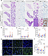 SARS-CoV-2 MA10 infection causes variable levels of chronic eosinophilic pn