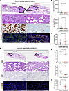 Therapeutic benefit of IL-33 pathway inhibition and prednisone treatment.