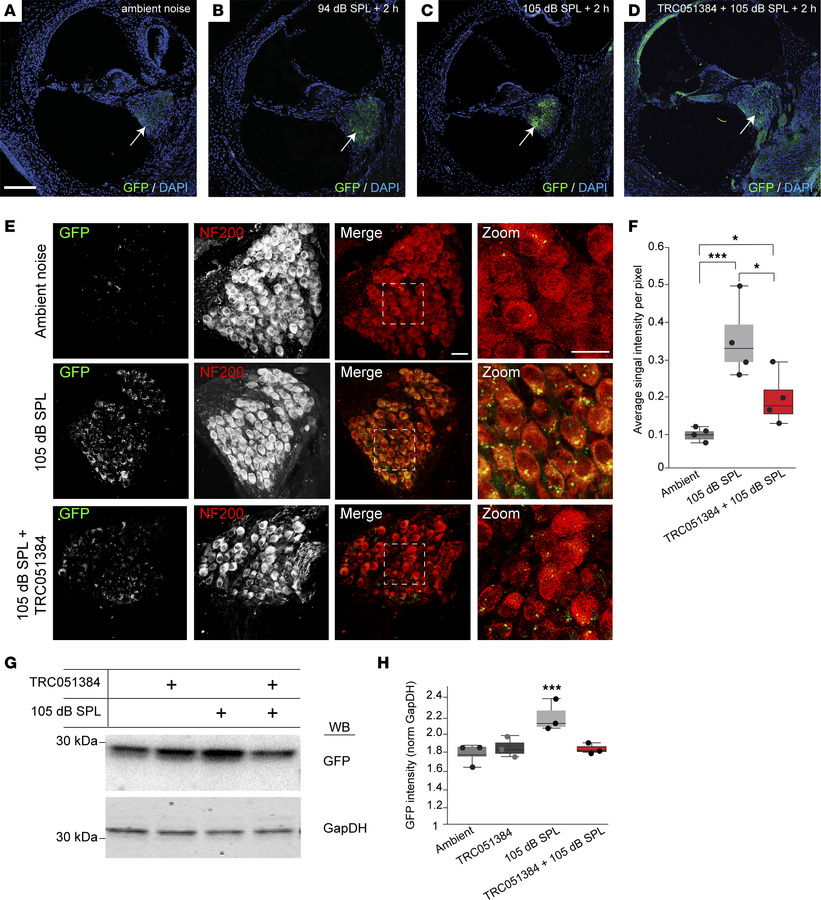 Prophylactic TRC051384 administration attenuates proteasomal impairments...