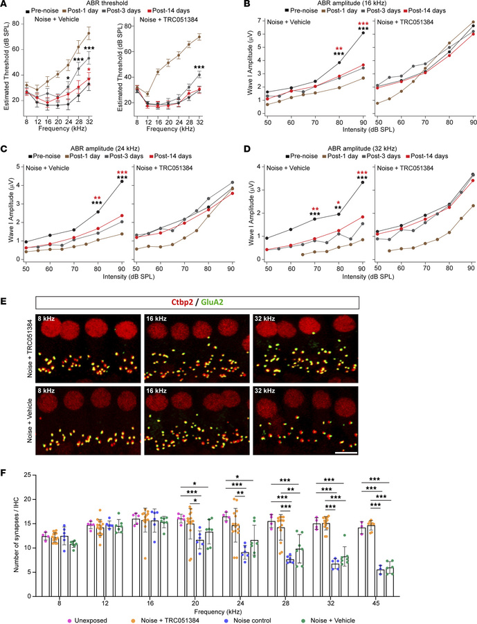 Prophylactic administration of TRC051384 accelerates recovery from noise...