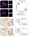 GeoMx spatial transcriptomics reveal that noise exposure selectively upregu