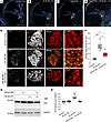Prophylactic TRC051384 administration attenuates proteasomal impairments in