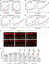 Prophylactic administration of TRC051384 accelerates recovery from noise ex